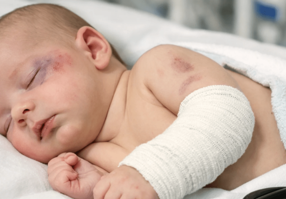 Bebê agredido em Afogados da Ingazeira