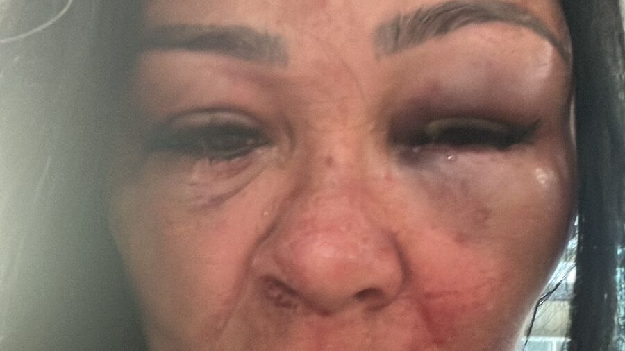 Denúncia de agressão em Arcoverde