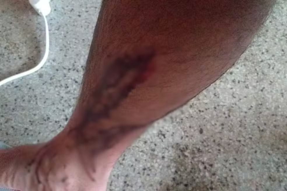 UFRPE é condenada em caso de estudante atacado por cães