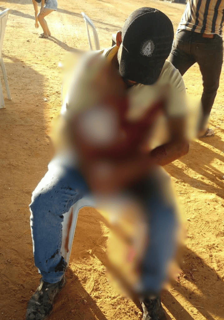 Jovem é ferido a golpes de faca na Pedra