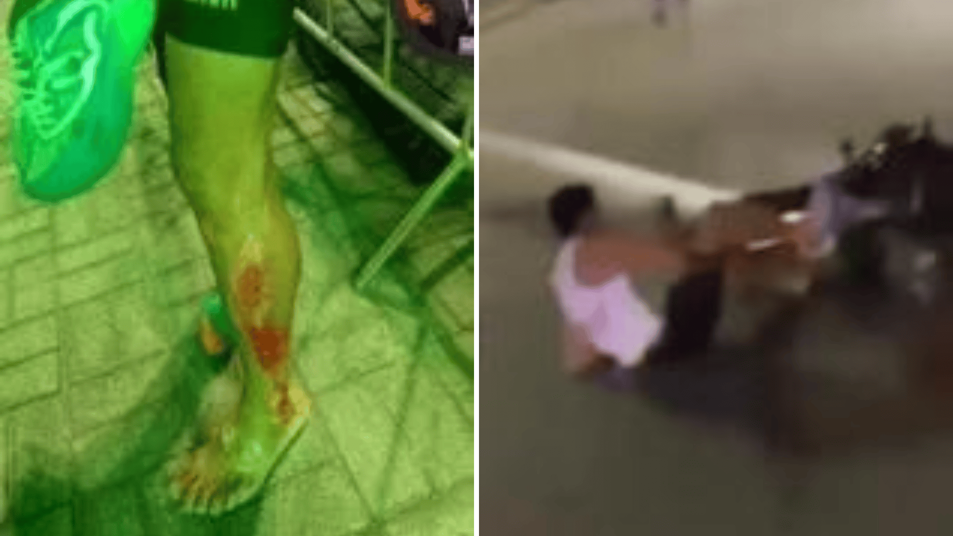 VÍDEO: Atleta é atingido por moto durante corrida noturna em Arcoverde